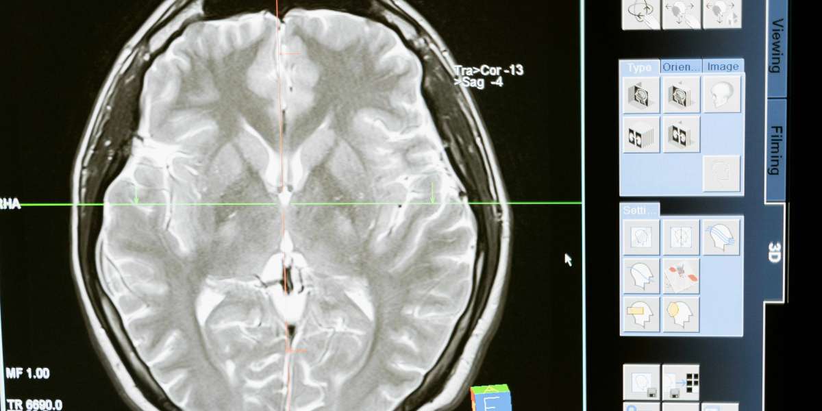 Neurological Disorder Models: A Pathway to Understanding and Treating Brain Diseases